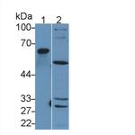 MMP1 Antibody in Western Blot (WB)