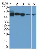 Acid Phosphatase 2 Antibody in Western Blot (WB)