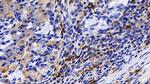 Tryptase Antibody in Immunohistochemistry (Paraffin) (IHC (P))