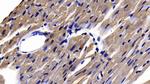 APAF1 Antibody in Immunohistochemistry (Paraffin) (IHC (P))