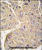 PTPN7 Antibody in Immunohistochemistry (Paraffin) (IHC (P))