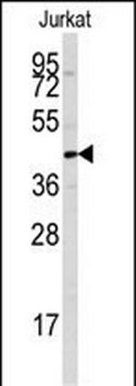 PTPN7 Antibody in Western Blot (WB)