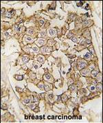 ErbB2 (HER-2) Antibody in Immunohistochemistry (Paraffin) (IHC (P))