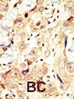 ErbB4 Antibody in Immunohistochemistry (Paraffin) (IHC (P))