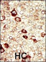 FGFR4 Antibody in Immunohistochemistry (Paraffin) (IHC (P))