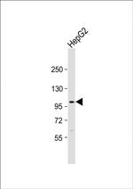 FGFR4 Antibody in Western Blot (WB)