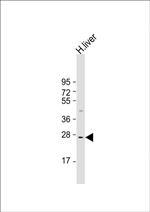 IGFBP3 Antibody in Western Blot (WB)