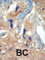 FLT3 Antibody in Immunohistochemistry (Paraffin) (IHC (P))