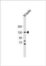 FLT3 Antibody in Western Blot (WB)