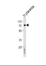 FUCA2 Antibody in Western Blot (WB)