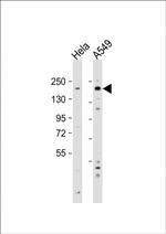 IGF1R alpha Antibody in Western Blot (WB)