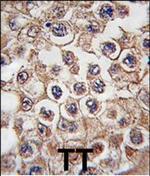 INSRR Antibody in Immunohistochemistry (Paraffin) (IHC (P))