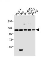 INSRR Antibody in Western Blot (WB)