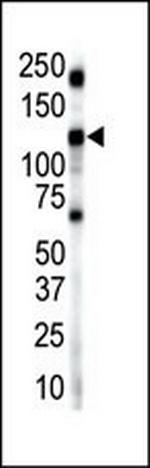 INSRR Antibody in Western Blot (WB)