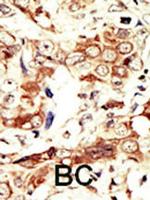 INSRR Antibody in Immunohistochemistry (Paraffin) (IHC (P))