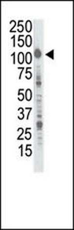 INSRR Antibody in Western Blot (WB)