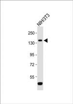 ROR1 Antibody in Western Blot (WB)