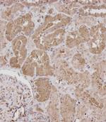 ROR1 Antibody in Immunohistochemistry (Paraffin) (IHC (P))