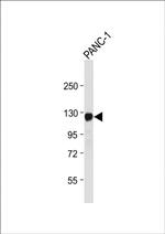 ROR1 Antibody in Western Blot (WB)