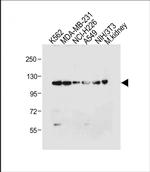 ROR1 Antibody in Western Blot (WB)