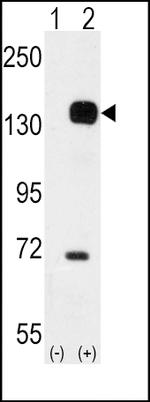 TEK Antibody in Western Blot (WB)