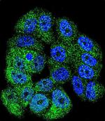 c-Abl Antibody in Immunocytochemistry (ICC/IF)