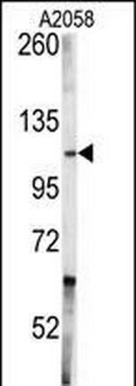 c-Abl Antibody in Western Blot (WB)