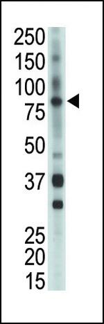 ETK Antibody in Western Blot (WB)