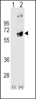 Fyn Antibody in Western Blot (WB)