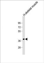 TRIB1 Antibody in Western Blot (WB)