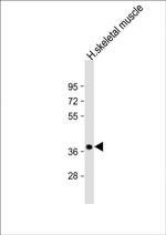 TRIB1 Antibody in Western Blot (WB)