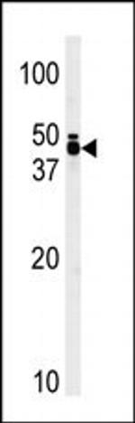 TRIB1 Antibody in Western Blot (WB)