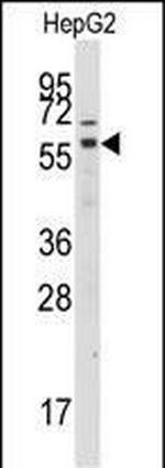 GRK7 Antibody in Western Blot (WB)