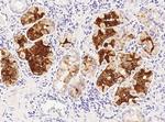 Cryptic Antibody in Immunohistochemistry (Paraffin) (IHC (P))