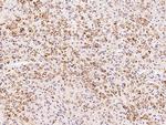 ADAT3 Antibody in Immunohistochemistry (Paraffin) (IHC (P))