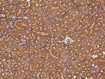 Clathrin Heavy Chain Antibody in Immunohistochemistry (Paraffin) (IHC (P))