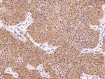 NUDT5 Antibody in Immunohistochemistry (Paraffin) (IHC (P))