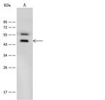 B1 Bradykinin Receptor Antibody in Western Blot (WB)