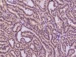 TXNL1 Antibody in Immunohistochemistry (Paraffin) (IHC (P))