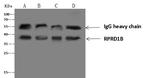 RPRD1B Antibody in Immunoprecipitation (IP)