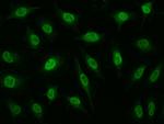 RPRD1B Antibody in Immunocytochemistry (ICC/IF)