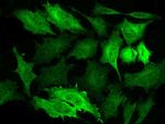 NDRG1 Antibody in Immunocytochemistry (ICC/IF)