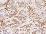 NDRG1 Antibody in Immunohistochemistry (Paraffin) (IHC (P))