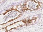 NDRG1 Antibody in Immunohistochemistry (Paraffin) (IHC (P))