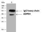 ADPRH Antibody in Immunoprecipitation (IP)