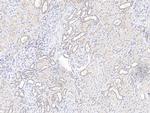 KBP Antibody in Immunohistochemistry (Paraffin) (IHC (P))