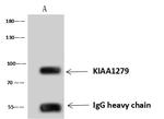 KBP Antibody in Immunoprecipitation (IP)