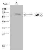 CD223 Antibody in Immunoprecipitation (IP)