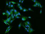 Rabex-5 Antibody in Immunocytochemistry (ICC/IF)