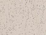 PSMD4 Antibody in Immunohistochemistry (Paraffin) (IHC (P))